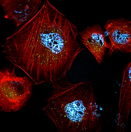 Diseñan nanopartículas que se 'despiertan' con luz ultravioleta para atacar  al tumor